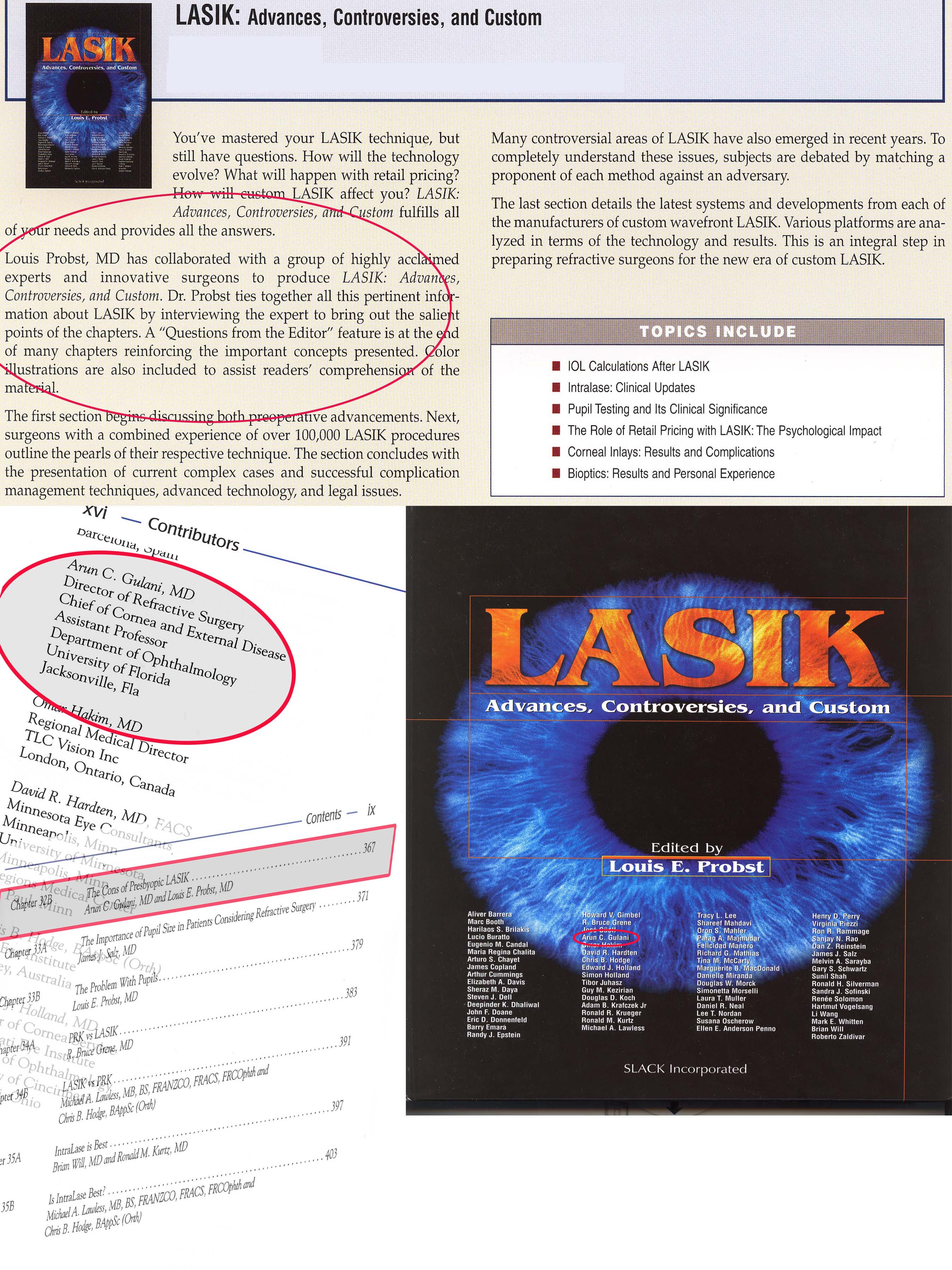 NEXGEN LASIK Jacksonville LASIK Surgery Jacksonville Gulani Vision